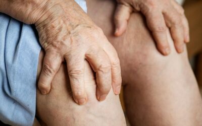 Innovations in Lymphoedema Care: What Patients Need to Know
